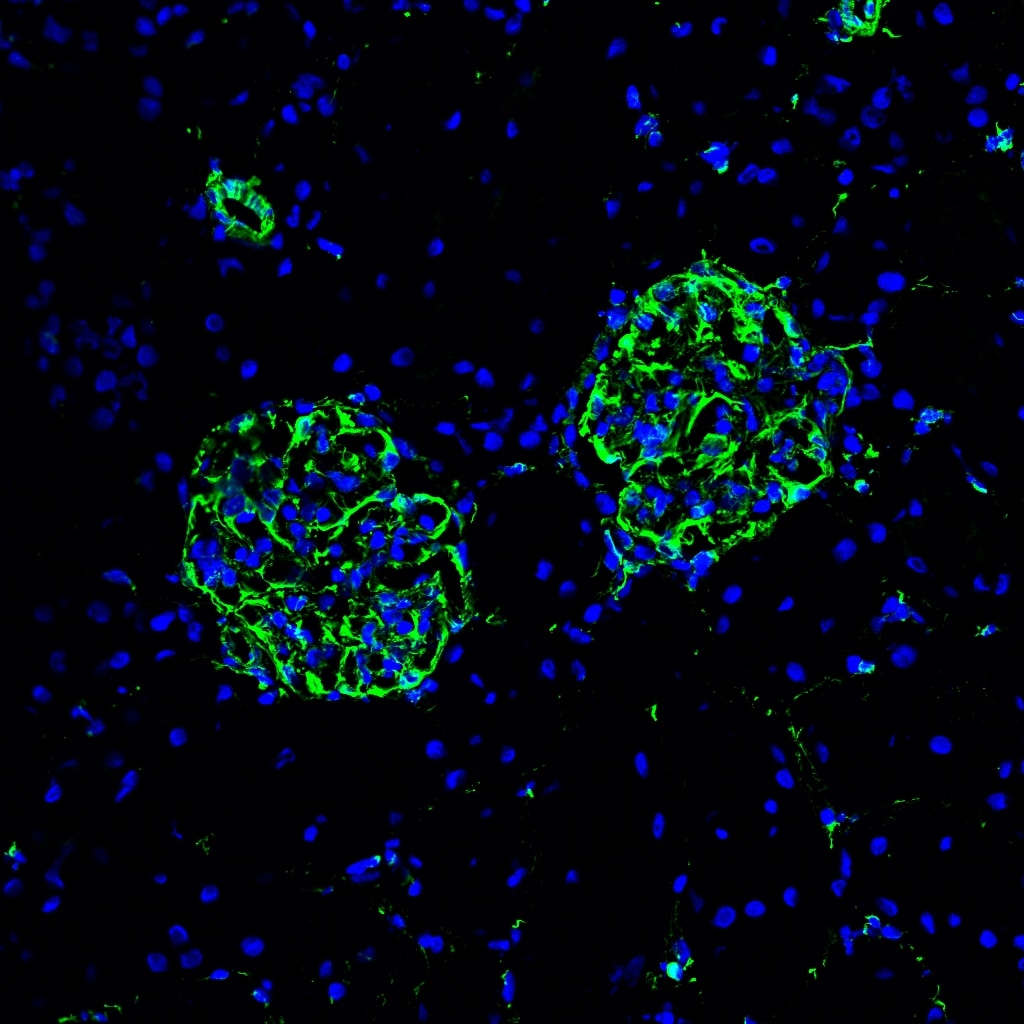 Vimentin Antibody NB300-223