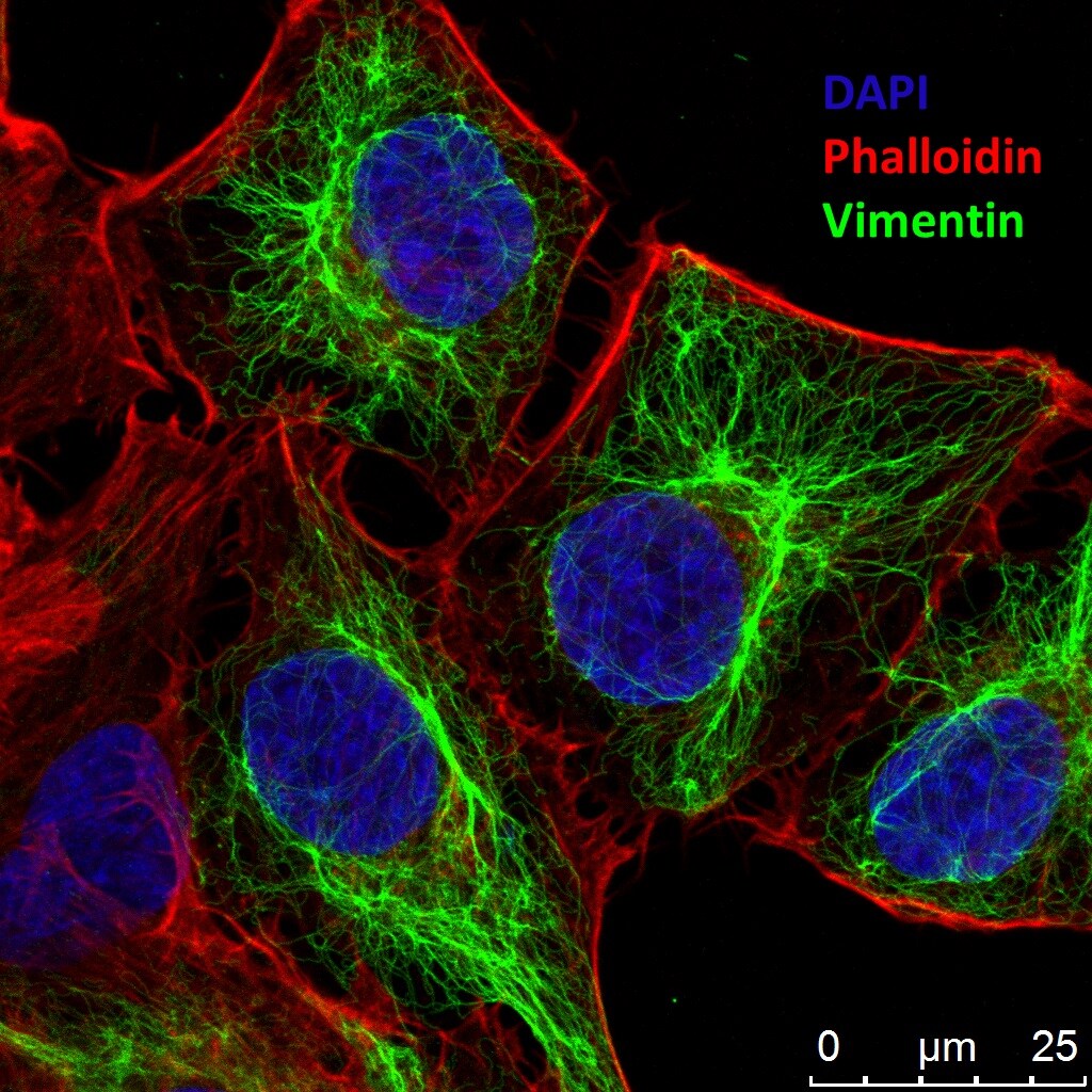 Vimentin Antibody NB300-223