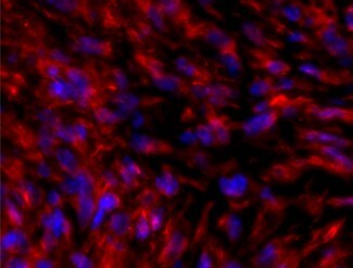 Vimentin Antibody NB300-223