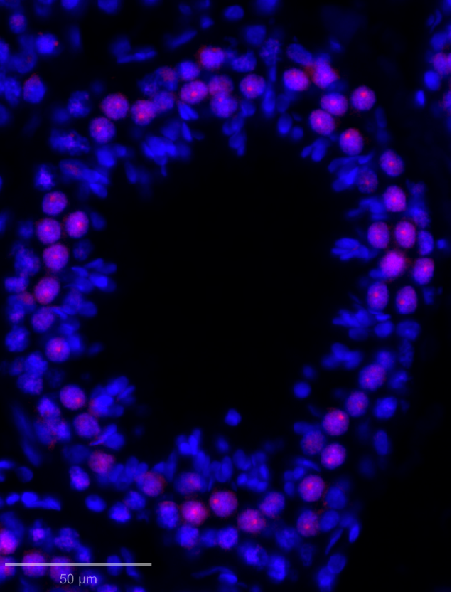 SCP3/SYCP3 Antibody - BSA Free NB300-232