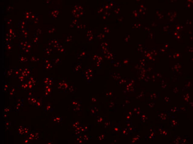 Fibrillarin Antibody (38F3) NB300-269