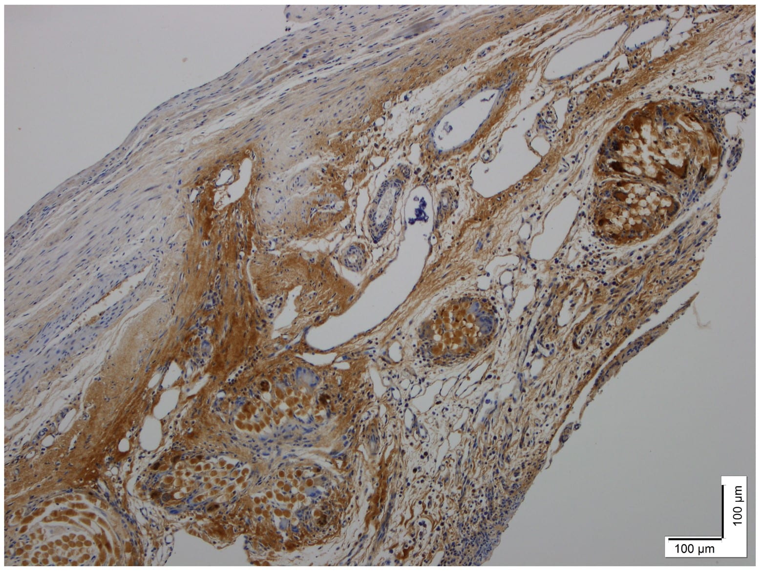 SERCA2 ATPase Antibody (2A7-A1) NB300-581