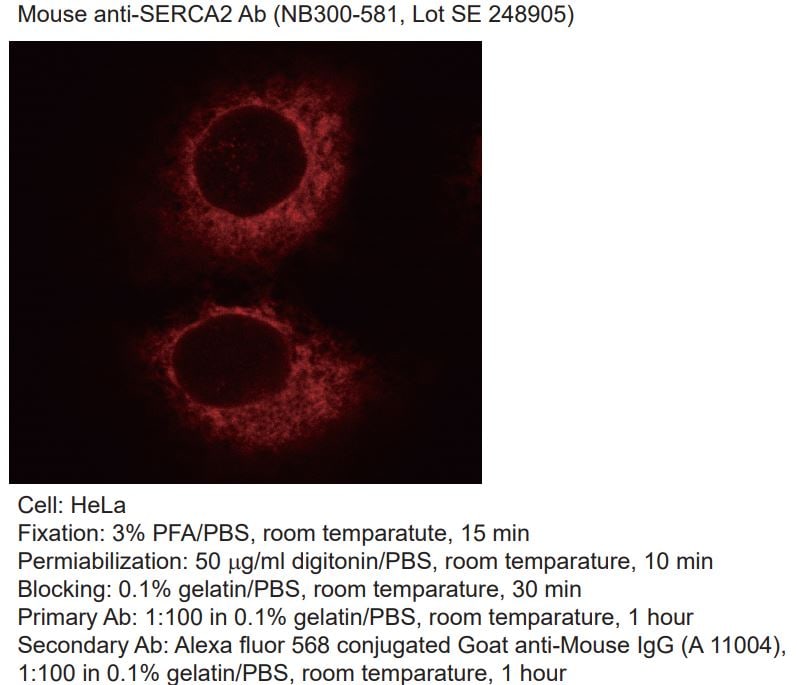 SERCA2 ATPase Antibody (2A7-A1) NB300-581