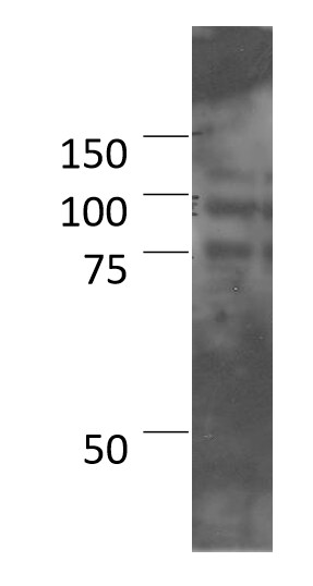 NFATC1/NFAT2 Antibody (7A6) NB300-620