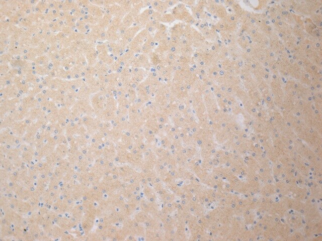 GR/NR3C1 Antibody (BuGR2) - BSA Free NB300-731