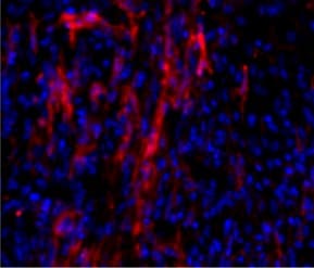 alpha-Smooth Muscle Actin Antibody NB300-978