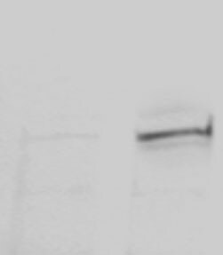 alpha-Smooth Muscle Actin Antibody NB300-978