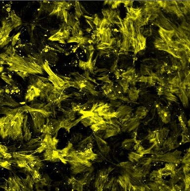 alpha-Smooth Muscle Actin Antibody NB300-978