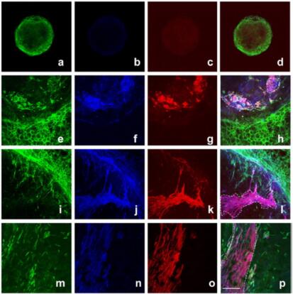 alpha-Smooth Muscle Actin Antibody NB300-978