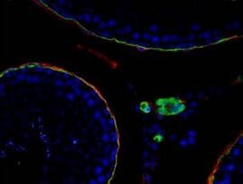 alpha-Smooth Muscle Actin Antibody NB300-978