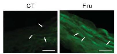 CHREBP Antibody - BSA Free NB400-135