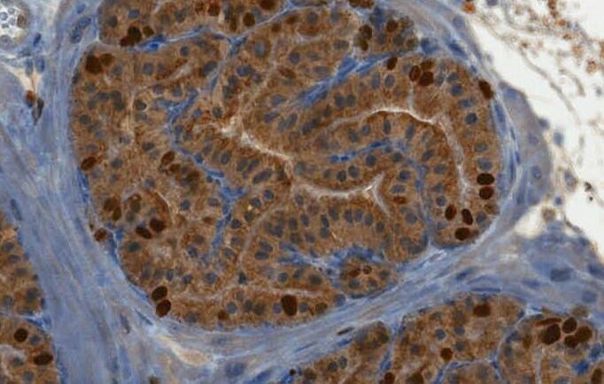 Ki67/MKI67 Antibody - BSA Free NB500-170