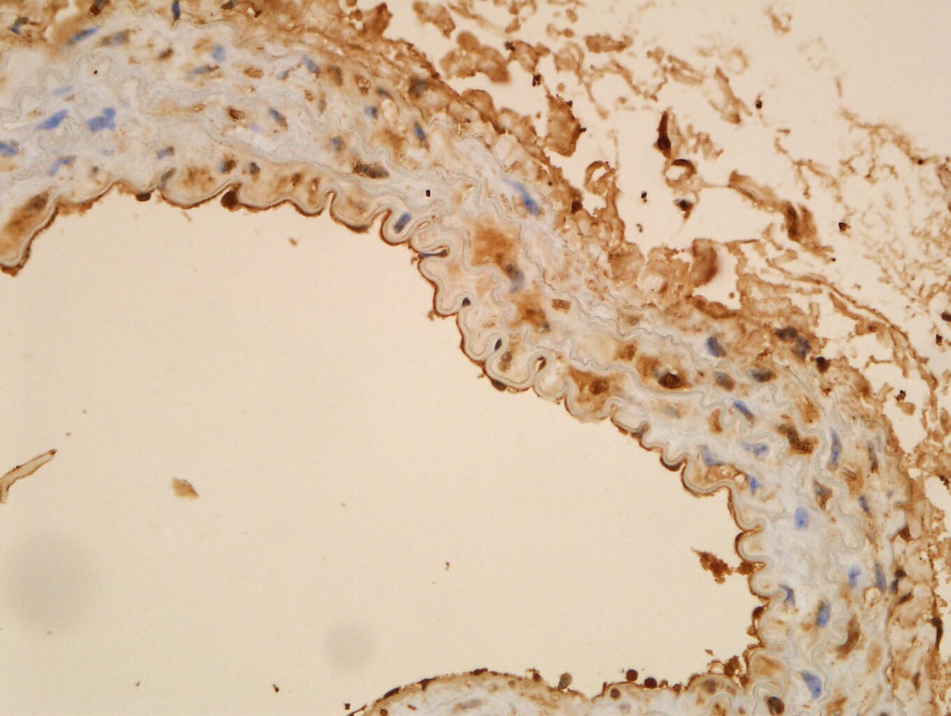 Ki67/MKI67 Antibody - BSA Free NB500-170