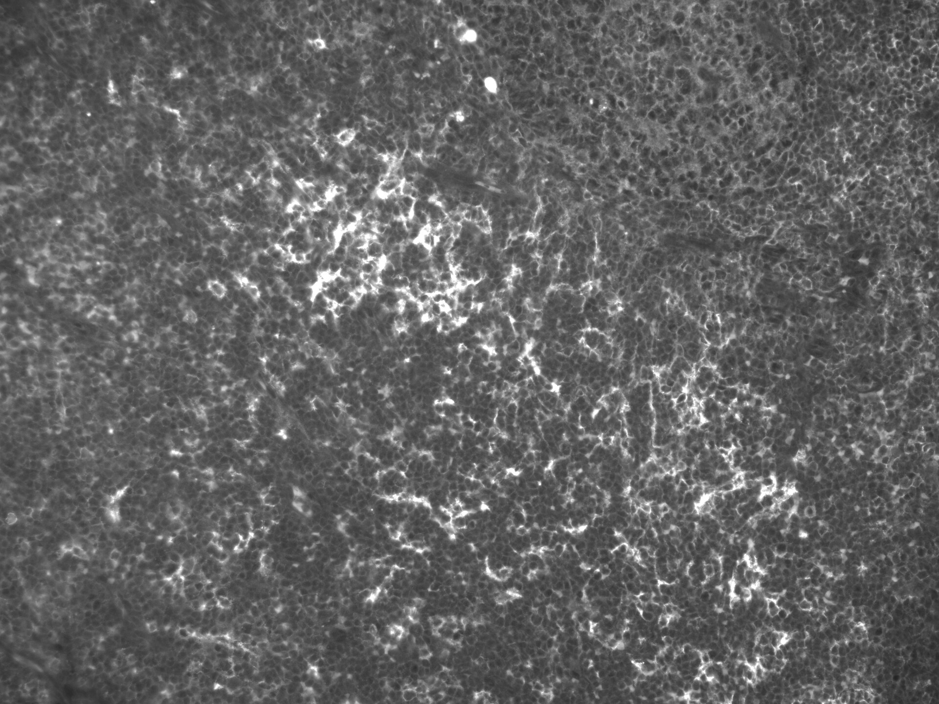 beta 2-Microglobulin Antibody (B2M-01) - BSA Free NB500-317