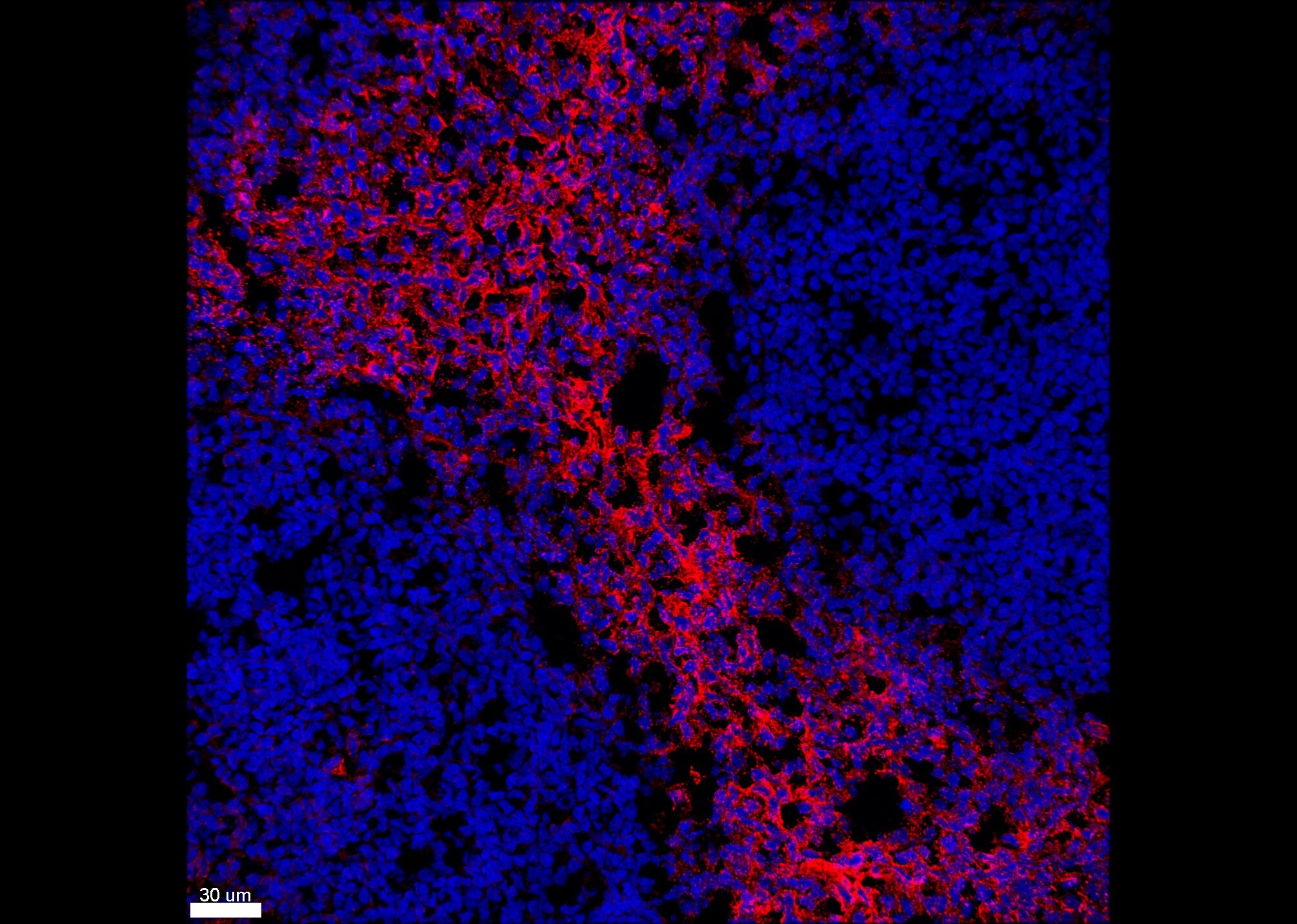 CD59 Antibody (MEM-43) - BSA Free NB500-330