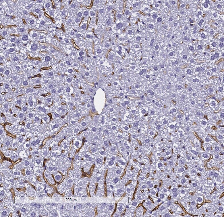 LYVE-1 Antibody - Azide and BSA Free NB600-1008
