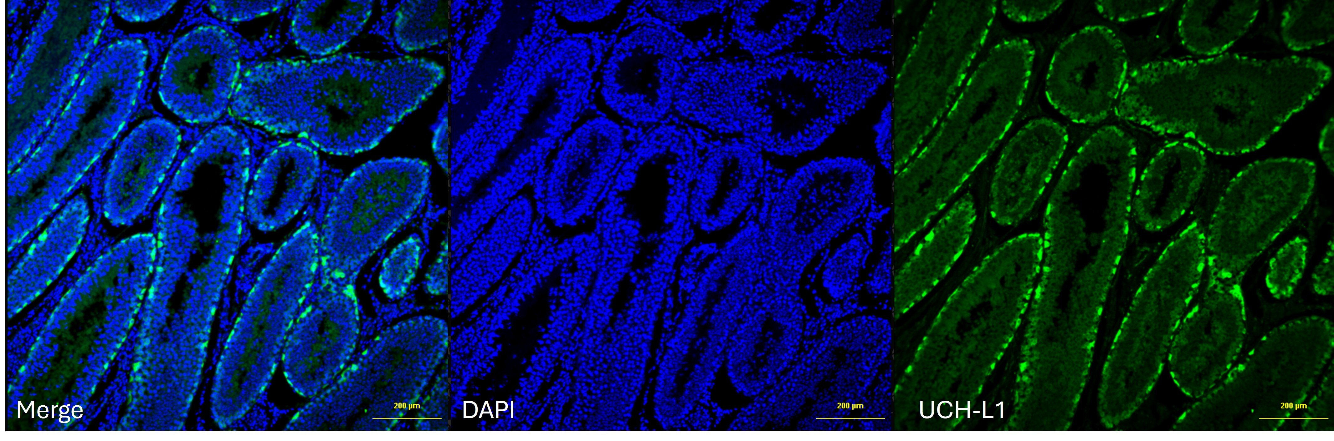 UCH-L1/PGP9.5 Antibody (31A3) NB600-1160