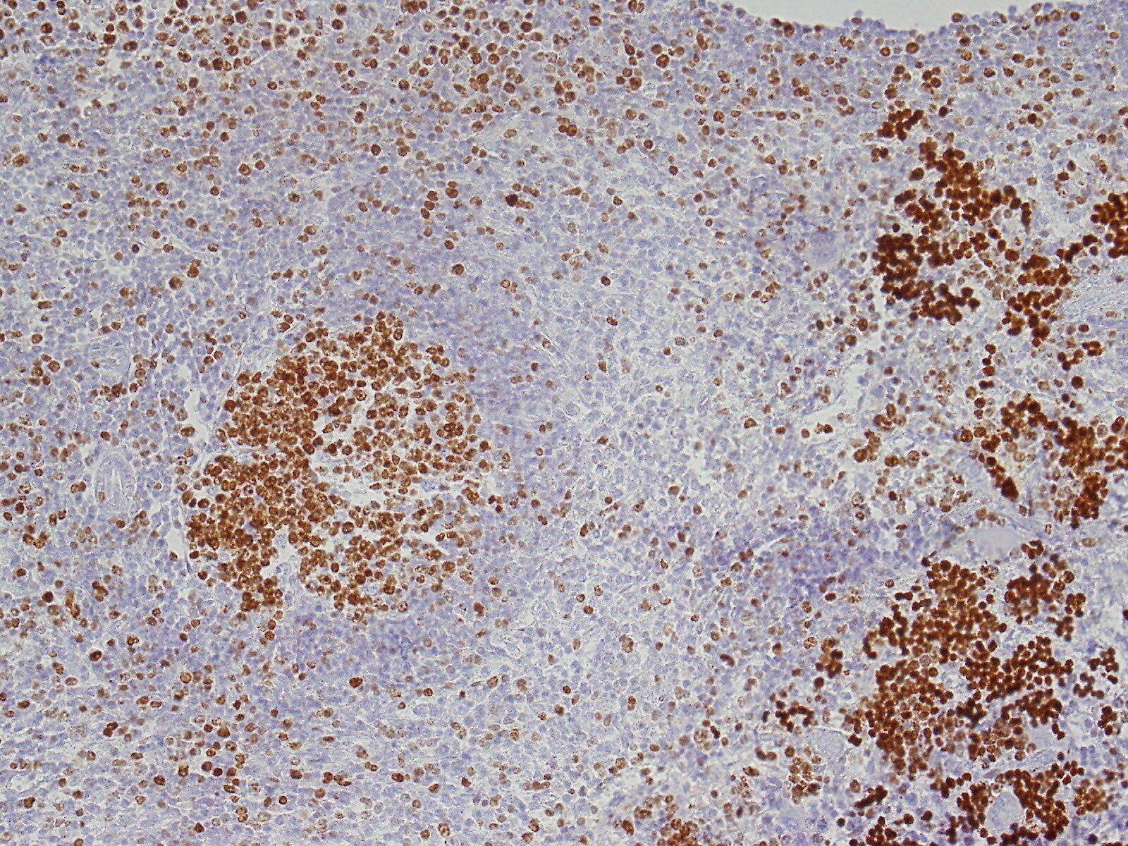 Ki67/MKI67 Antibody (SP6) - Unpurified NB600-1252