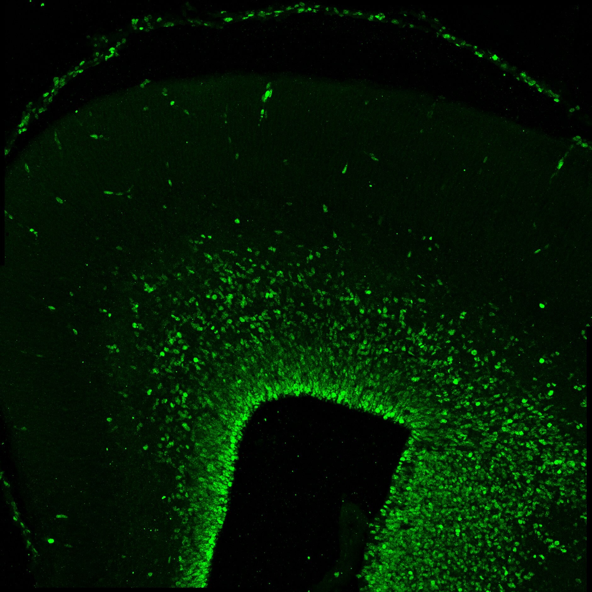 Ki67/MKI67 Antibody (SP6) - Unpurified NB600-1252