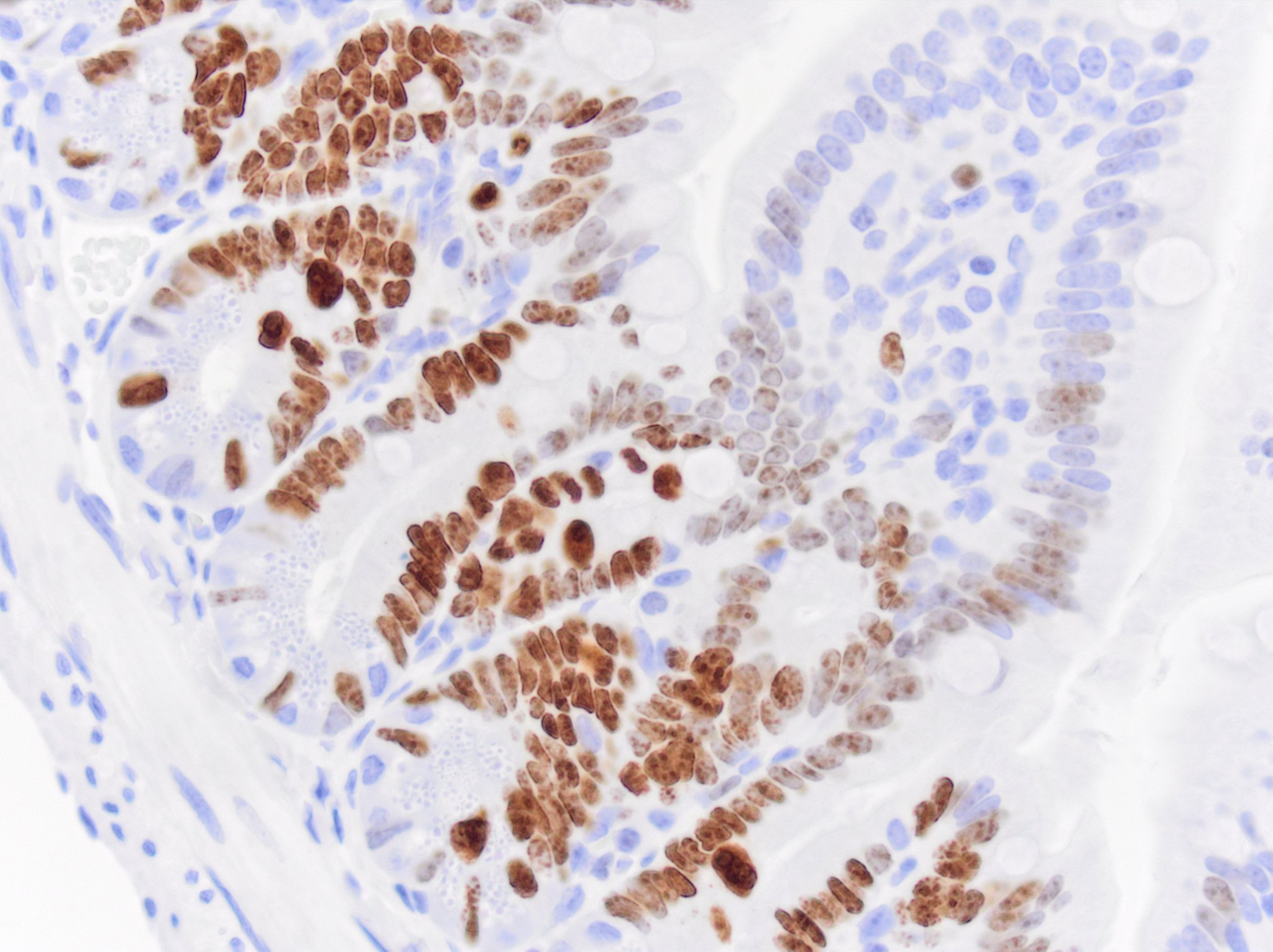 Ki67/MKI67 Antibody (SP6) - Unpurified NB600-1252