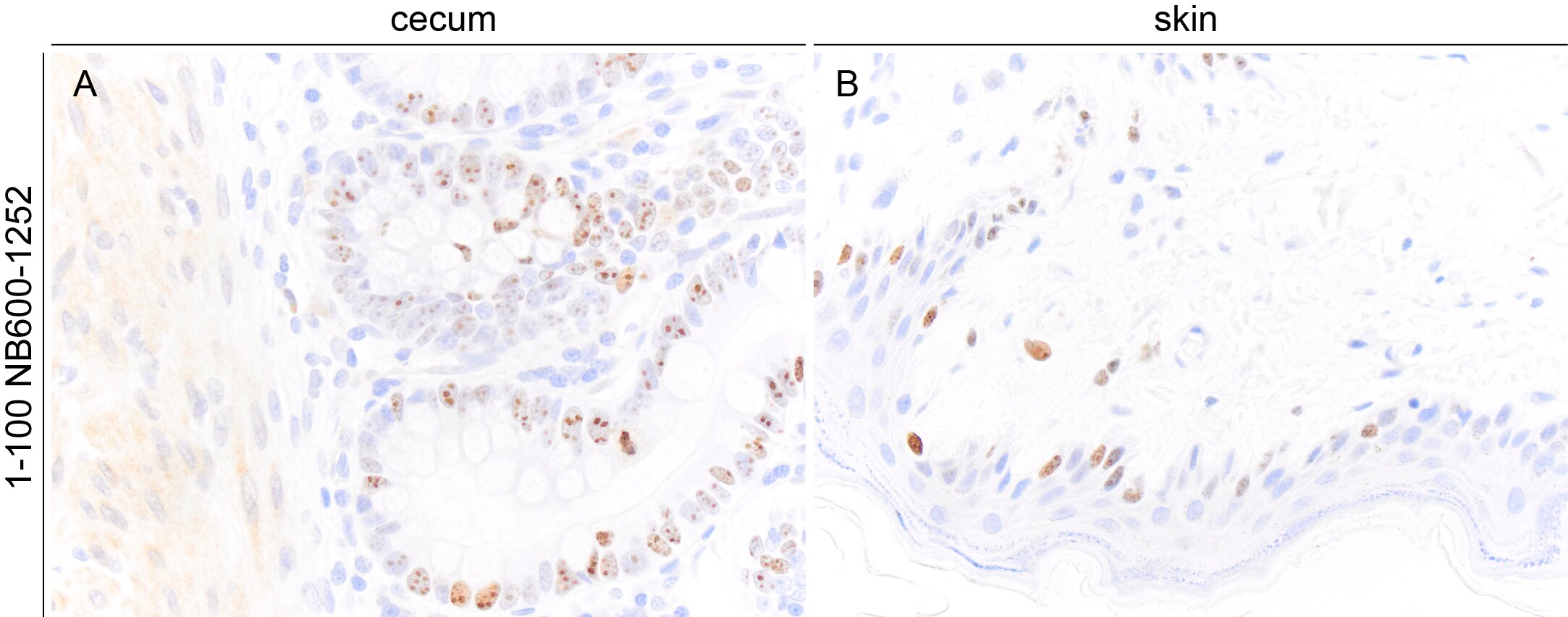 Ki67/MKI67 Antibody (SP6) - Unpurified NB600-1252