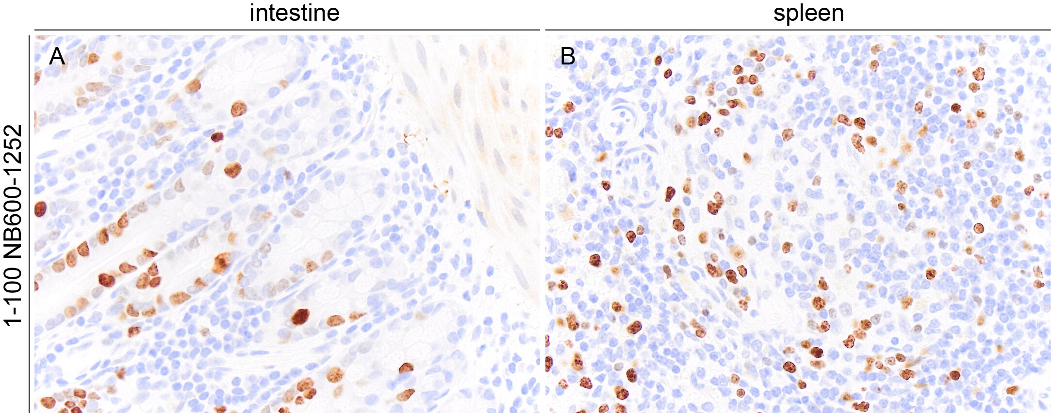 Ki67/MKI67 Antibody (SP6) - Unpurified NB600-1252