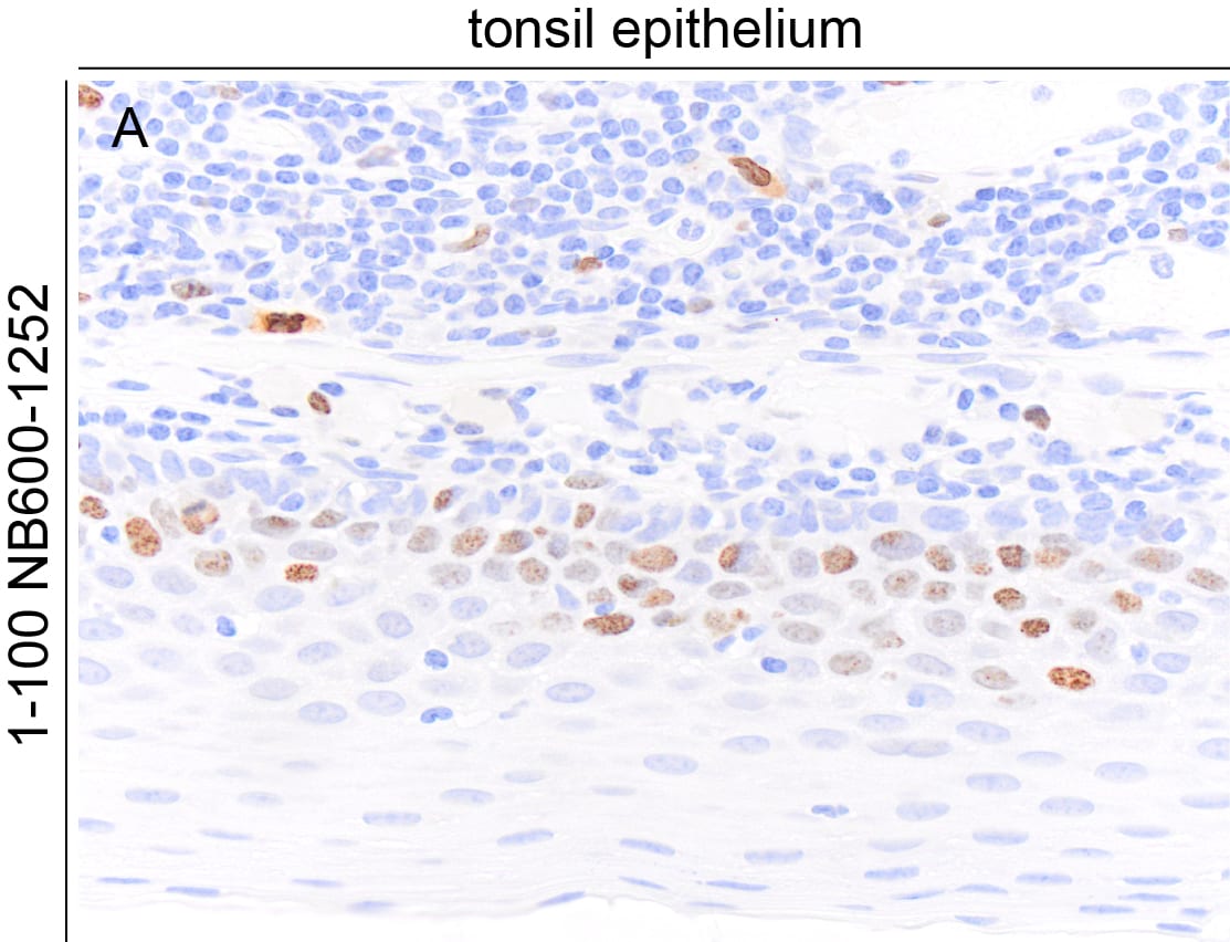 Ki67/MKI67 Antibody (SP6) - Unpurified NB600-1252