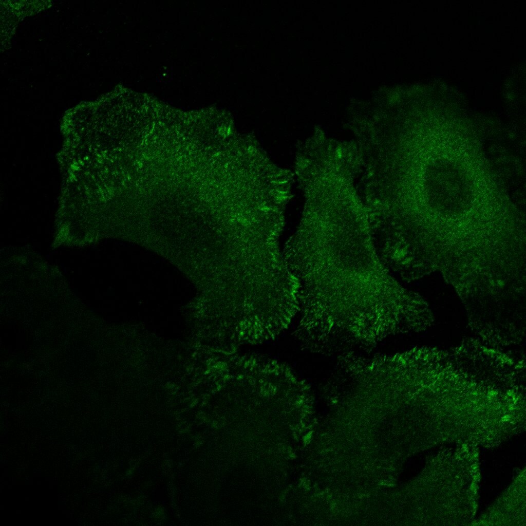 Vinculin Antibody (hVIN-1) NB600-1293