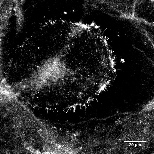 Ezrin Antibody (3C12) NB600-1310
