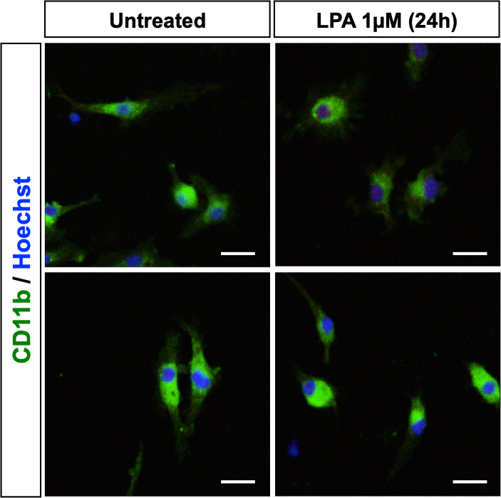 CD11b Antibody (M1/70.15) - BSA Free NB600-1327