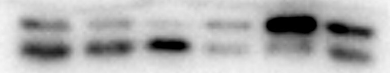 LC3B Antibody - BSA Free NB600-1384
