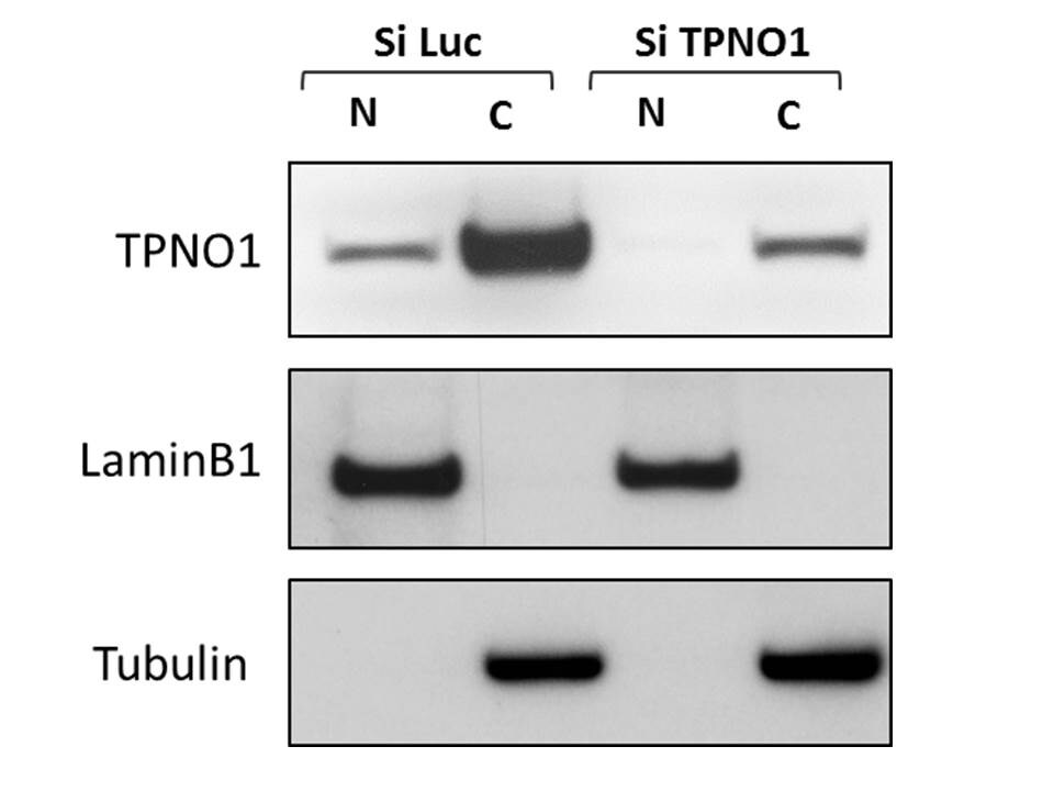 Transportin 1 Antibody (D45) - BSA Free NB600-1397