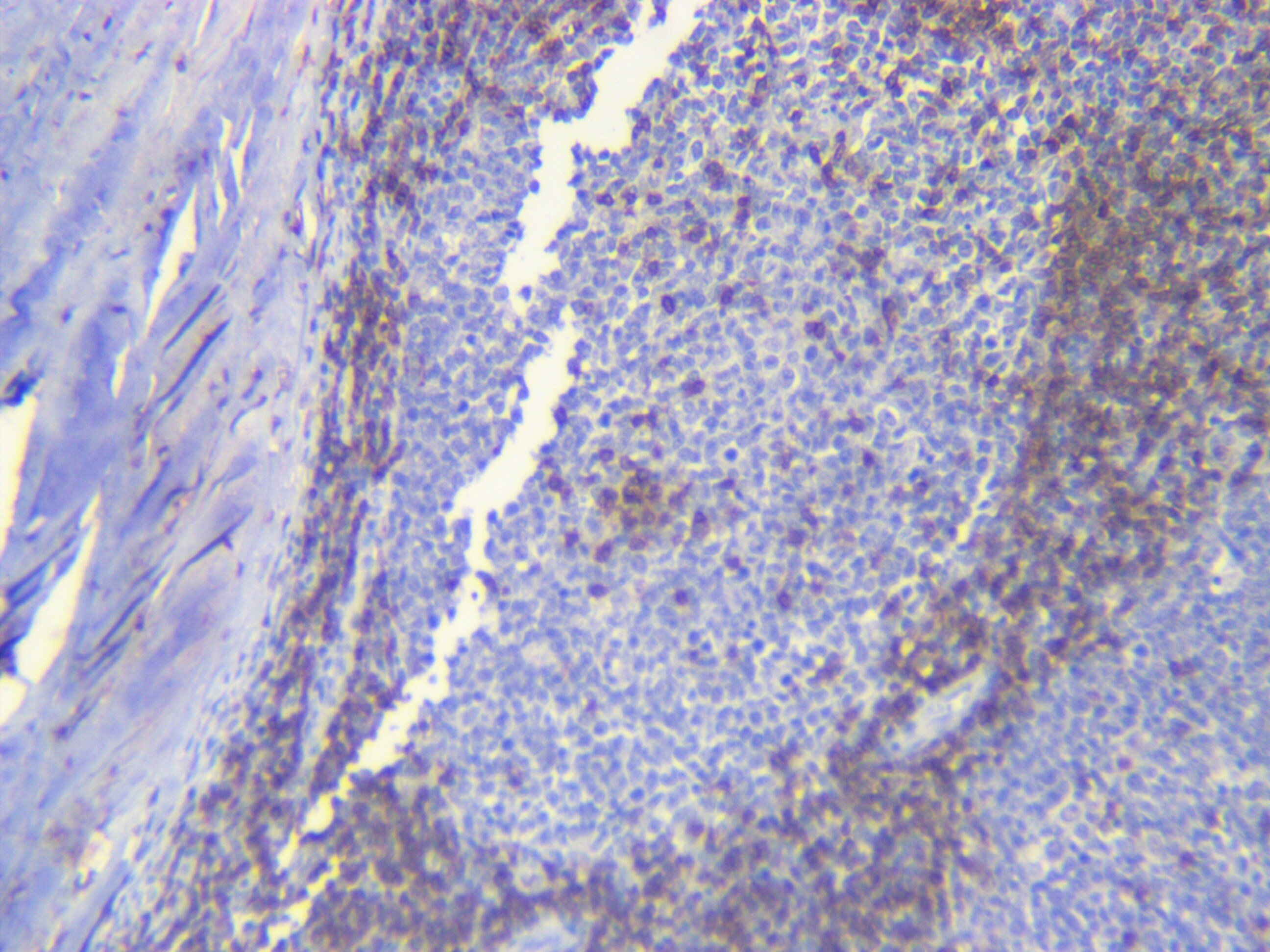 CD3 Antibody (SP7) NB600-1441