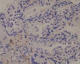 PKC alpha Antibody (MC5) - BSA Free NB600-201