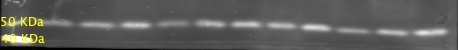 FoxP3 Antibody NB600-242
