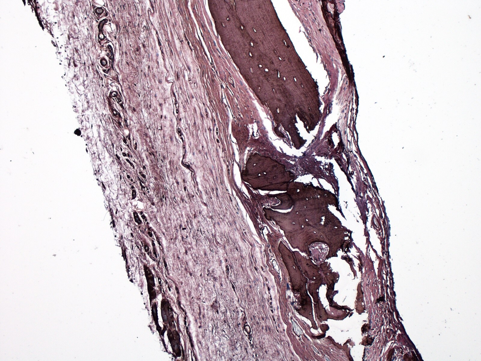 Collagen I Antibody - BSA Free NB600-408