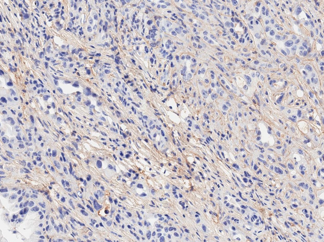Collagen I Antibody - BSA Free NB600-408