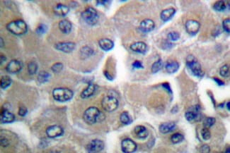 Collagen I Antibody - BSA Free NB600-408