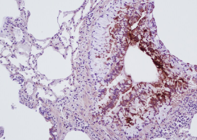 Collagen I Antibody - BSA Free NB600-408