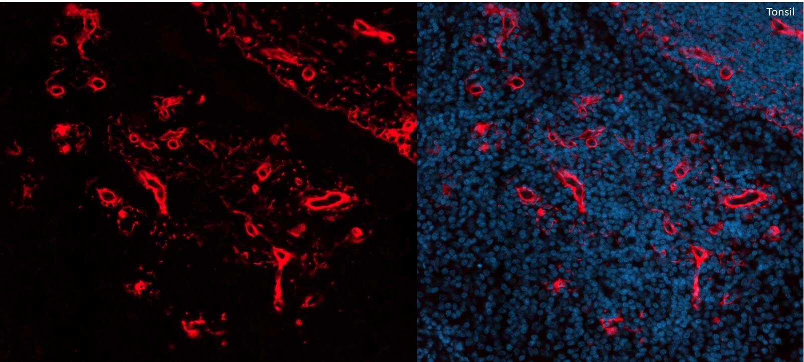 Collagen I Antibody [Alexa Fluor® 750] NB600-408AF750