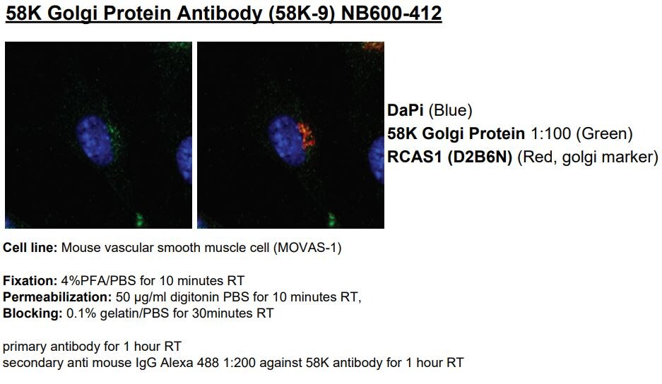 58K Golgi Protein Antibody (58K-9) - BSA Free NB600-412