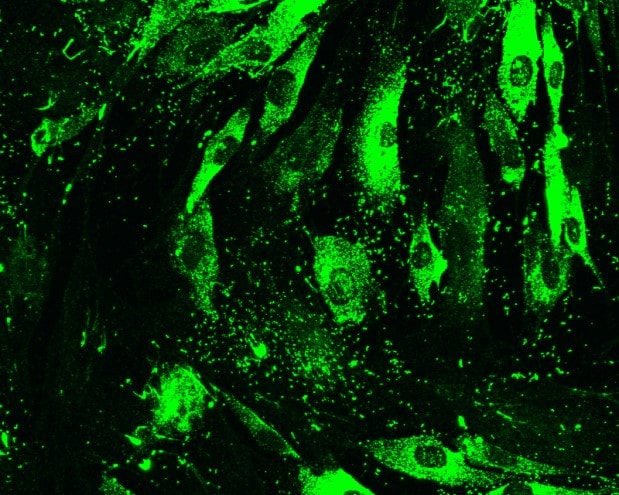 Collagen I alpha 1 Antibody (COL-1) NB600-450