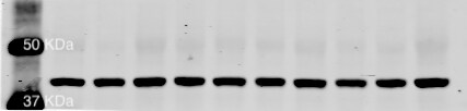 beta-Actin Antibody (AC-15) NB600-501