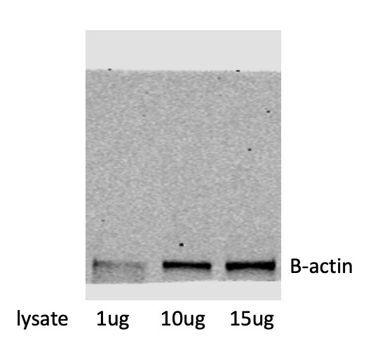 beta-Actin Antibody (AC-15) NB600-501