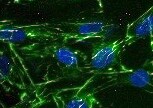 beta-Actin Antibody (AC-15) NB600-501