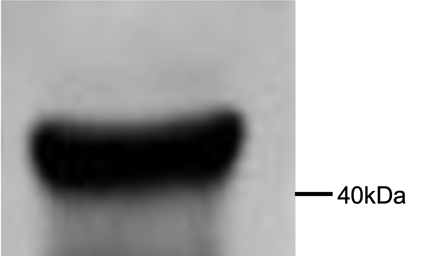 beta-Actin Antibody (AC-15) NB600-501