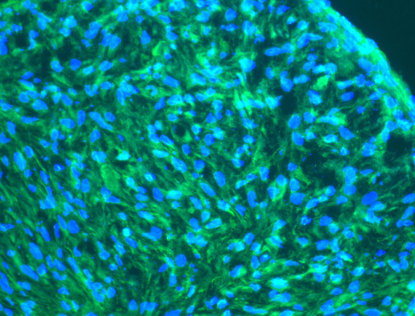 Transgelin/TAGLN/SM22 alpha Antibody NB600-507