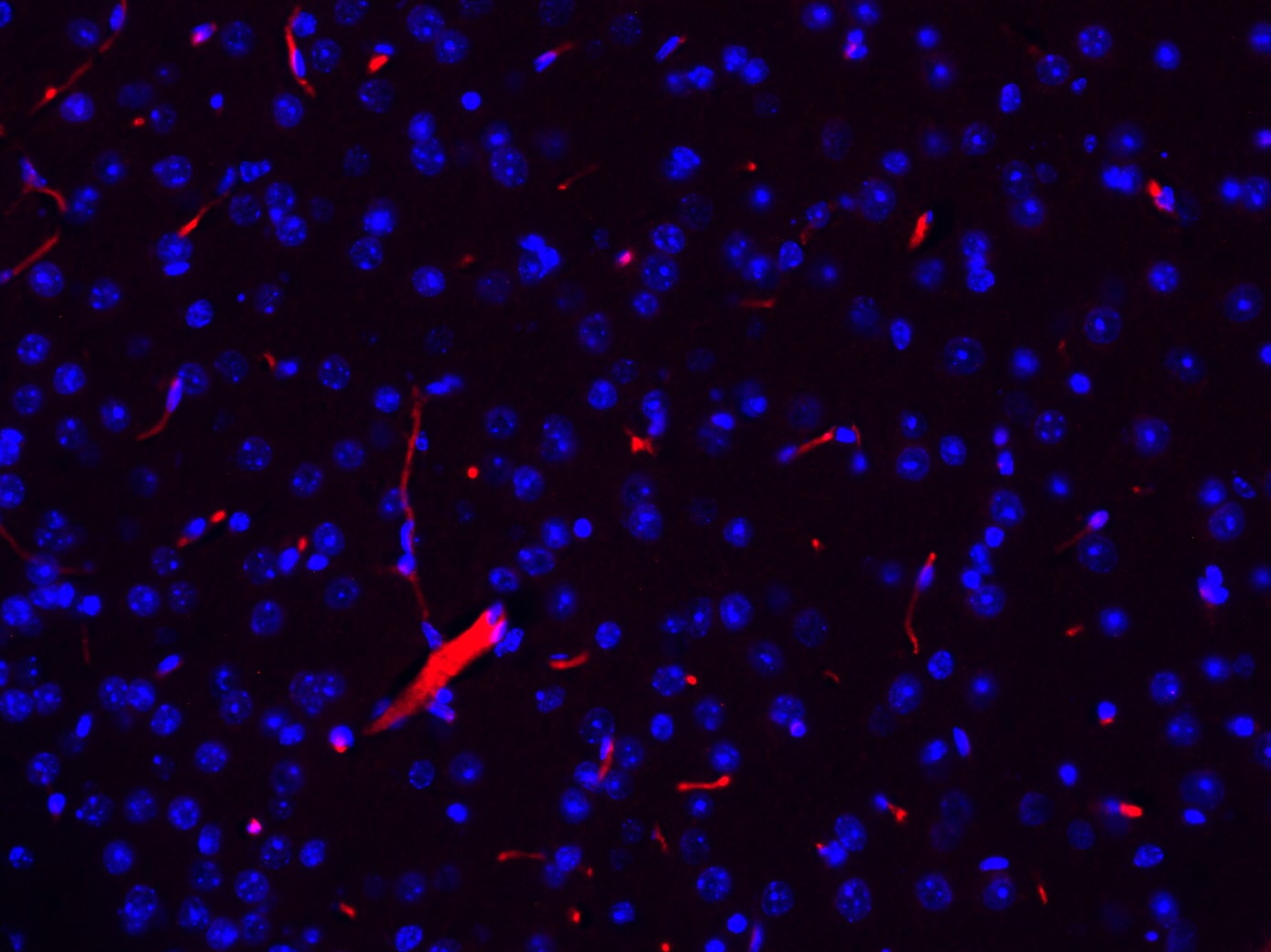 CD31/PECAM-1 Antibody (JC/70A) - BSA Free NB600-562