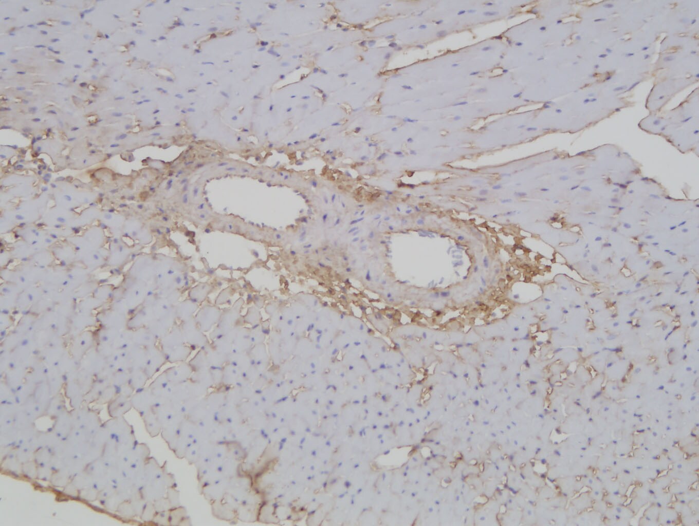 Collagen III alpha 1/COL3A1 Antibody - BSA Free NB600-594