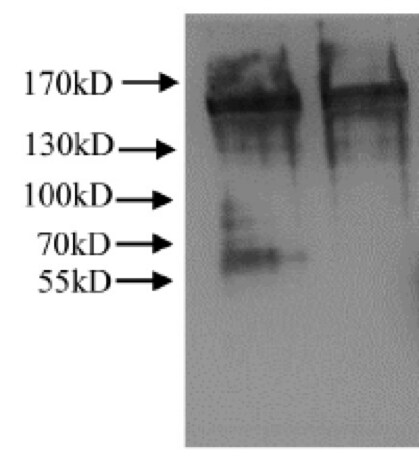 Collagen III alpha 1/COL3A1 Antibody - BSA Free NB600-594